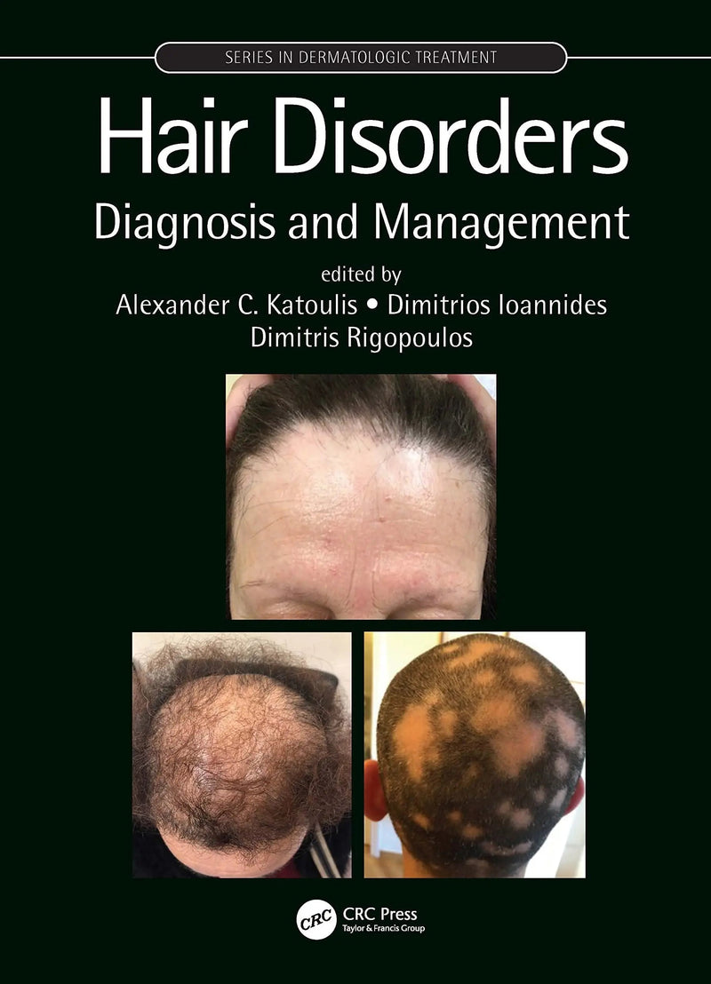 Hair Disorders Diagnosis and Management by Alexander C. Katoulis
