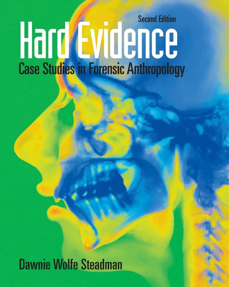 Hard Evidence Case Studies in Forensic Anthropology by Dawnie Wolfe Steadman