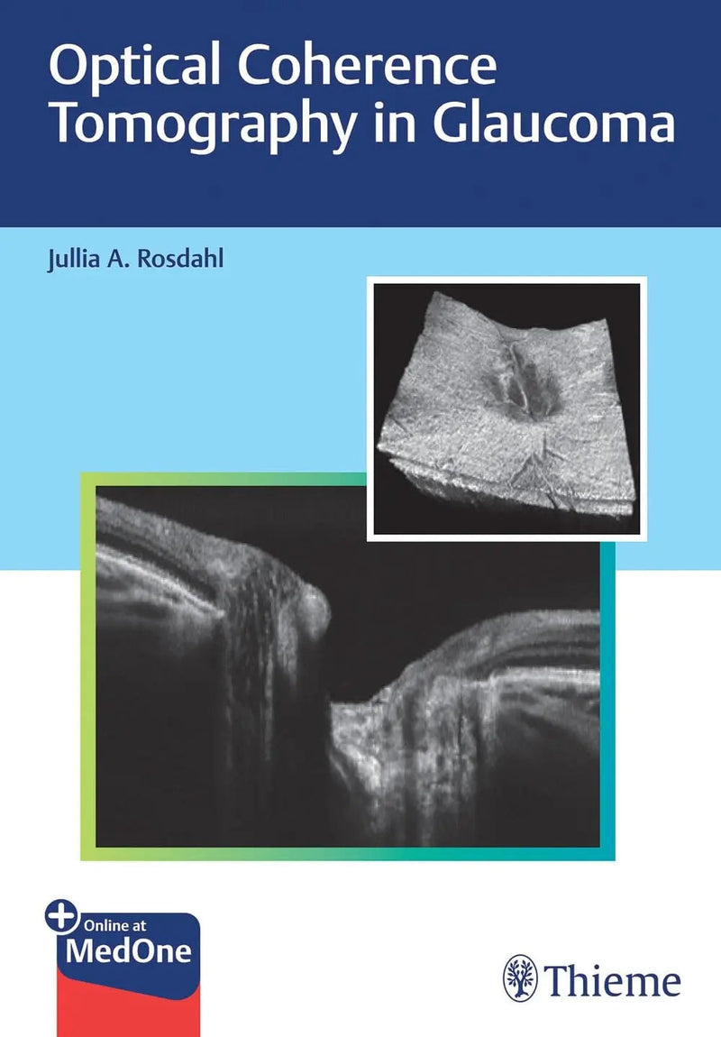 Optical Coherence Tomography in Glaucoma by Jullia Rosdahl