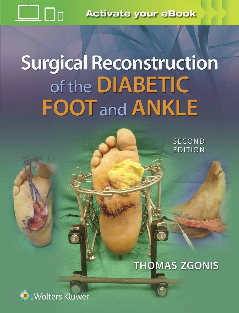 Surgical Reconstruction of the Diabetic Foot and Ankle by Thomas Zgonis