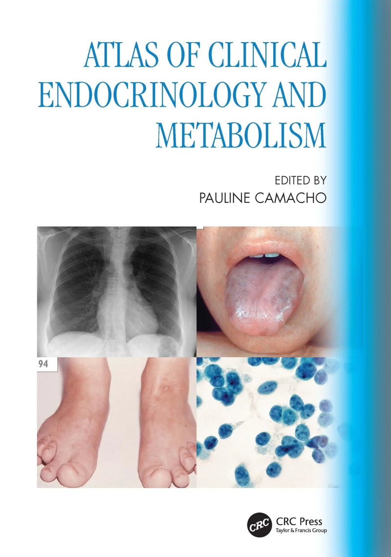 Atlas of Clinical Endocrinology and Metabolism by Pauline Camacho