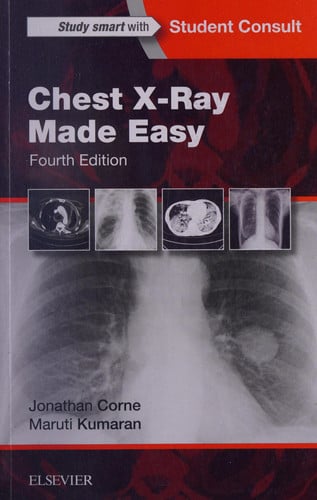 Chest X-Ray Made Easy by Jonathan Corne