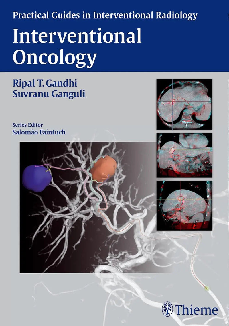 Interventional Oncology by Ripal T. Gandhi
