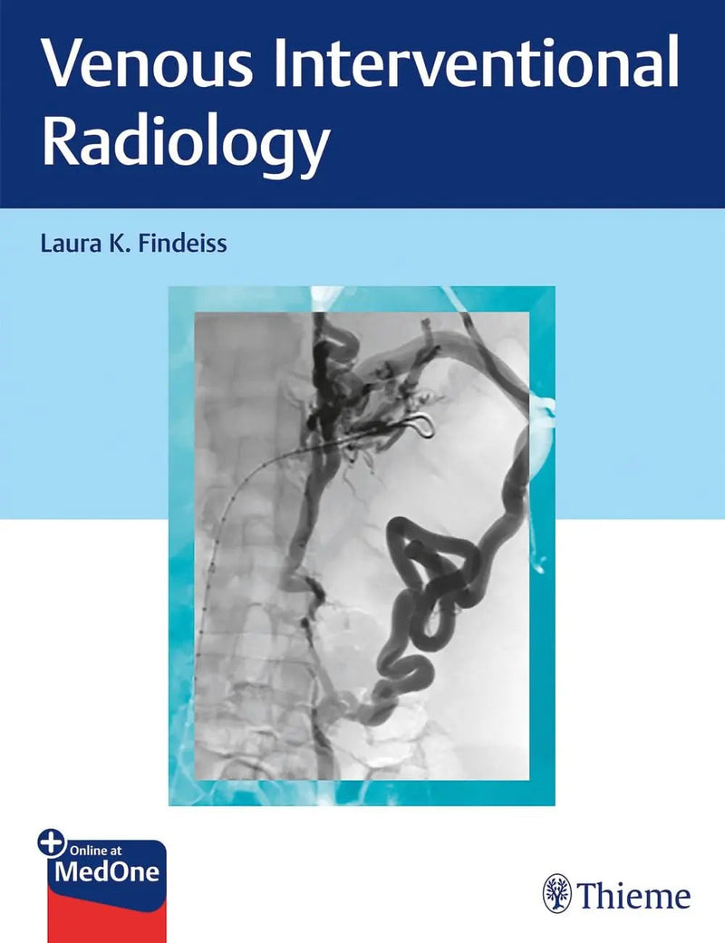 Venous Interventional Radiology by Laura K. Findeiss