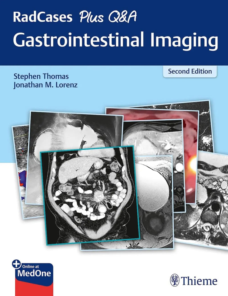 RadCases Gastrointestinal Imaging by Stephen Thomas