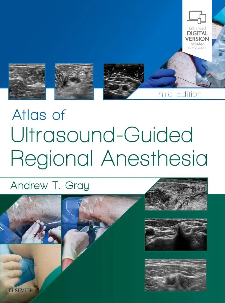 Atlas of Ultrasound-guided Regional Anesthesia by Andrew T. Gray