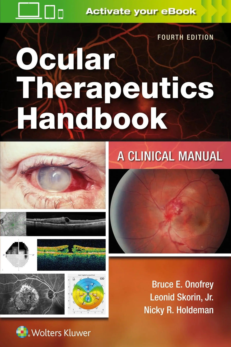 Ocular Therapeutics Handbook A Clinical Manual by Bruce E. Onofrey