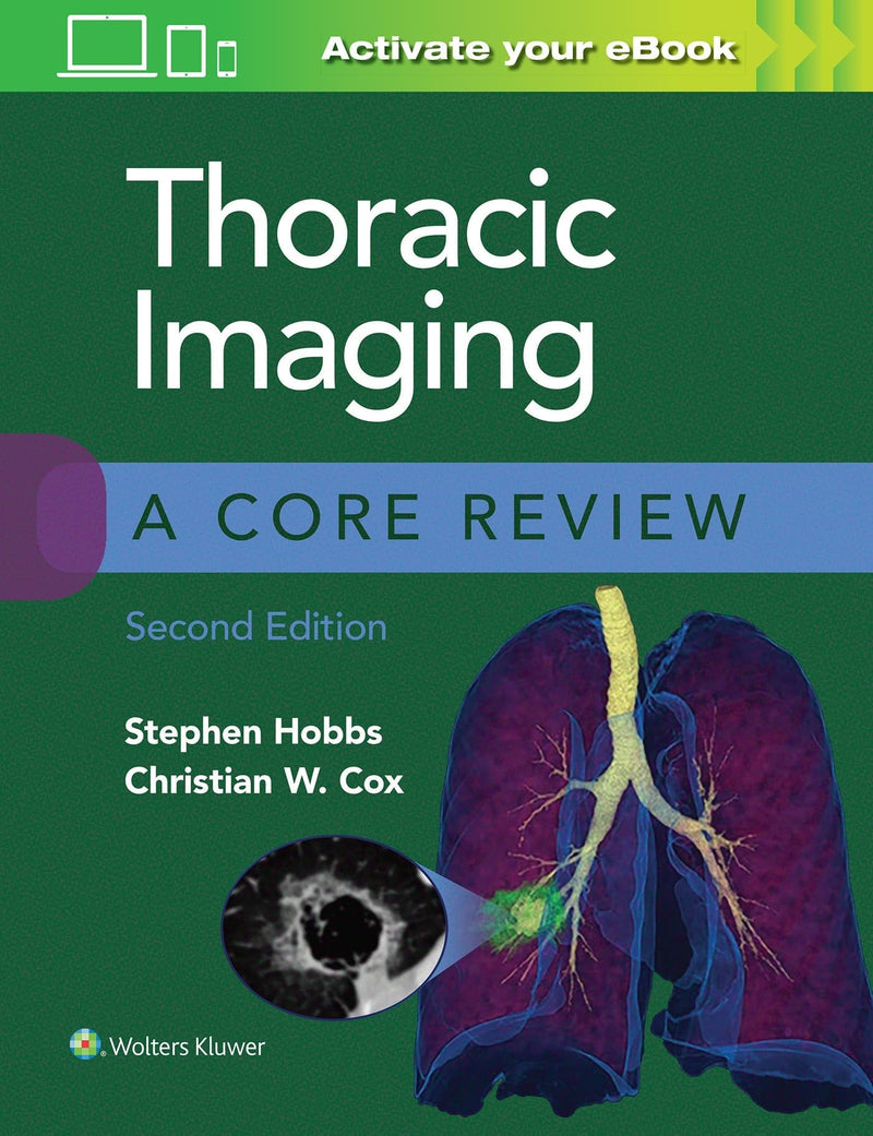 Thoracic Imaging A Core Review by Stephen B. Hobbs