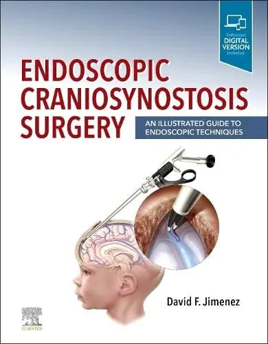 Endoscopic Craniosynostosis Surgery An Illustrated Guide to Endoscopic Techniques by David F. Jimenez