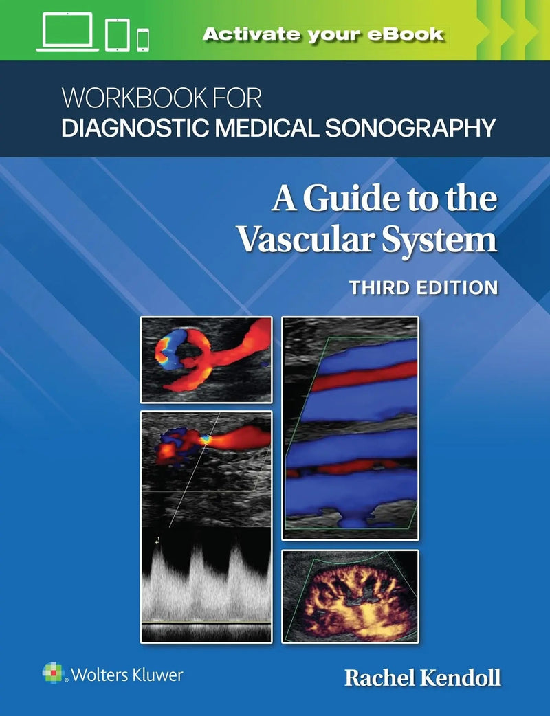 Workbook for Diagnostic Medical Sonography: the Vascular Systems by Ann Marie Kupinski