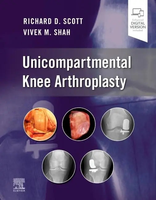 Unicompartmental Knee Arthroplasty by Richard D. Scott