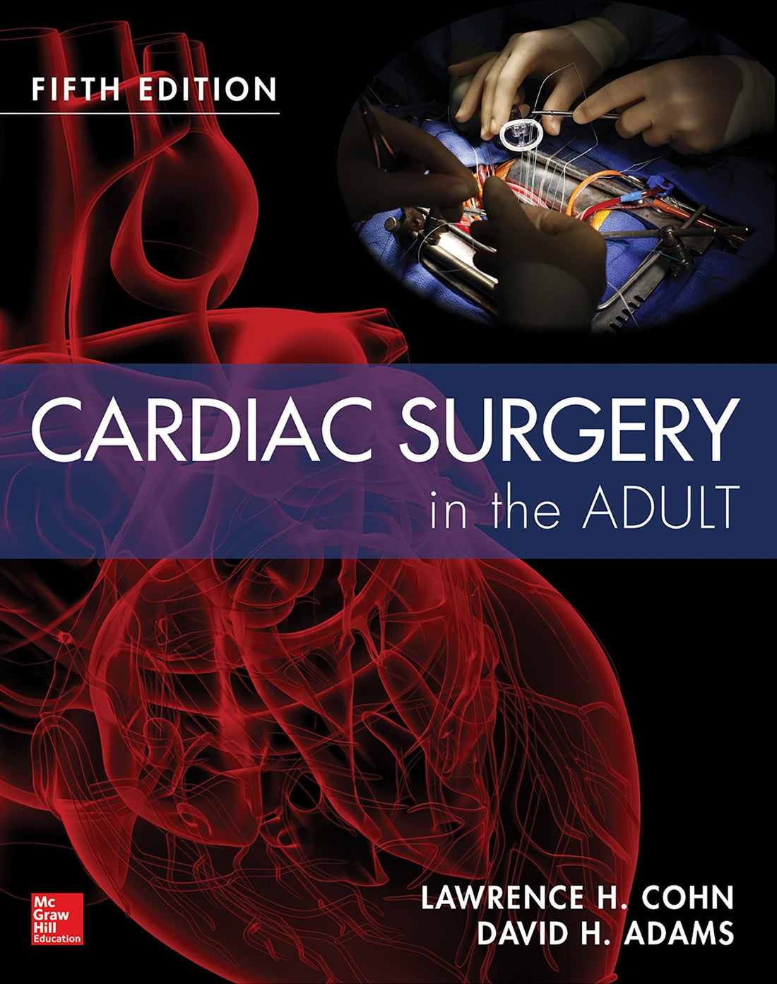 Cardiac Surgery in the Adult, Fifth Edition