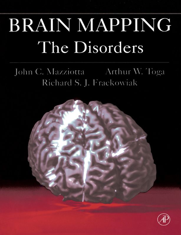 Brain Mapping: The Disorders: The Disorders