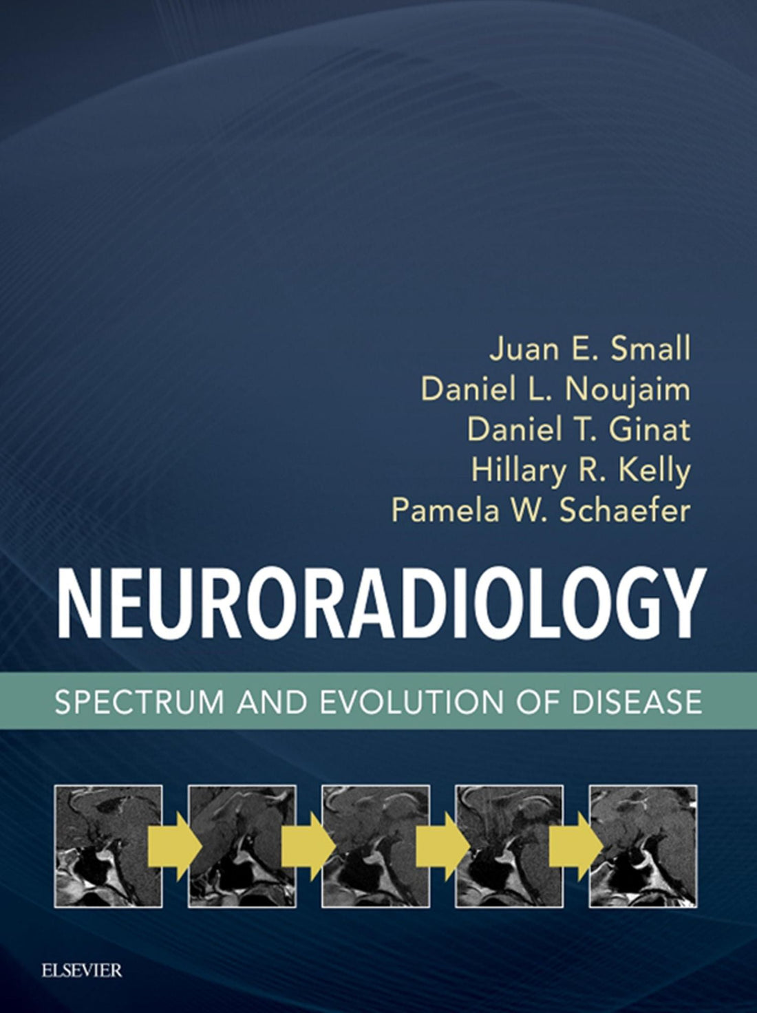 Neuroradiology: Spectrum and Evolution of Disease