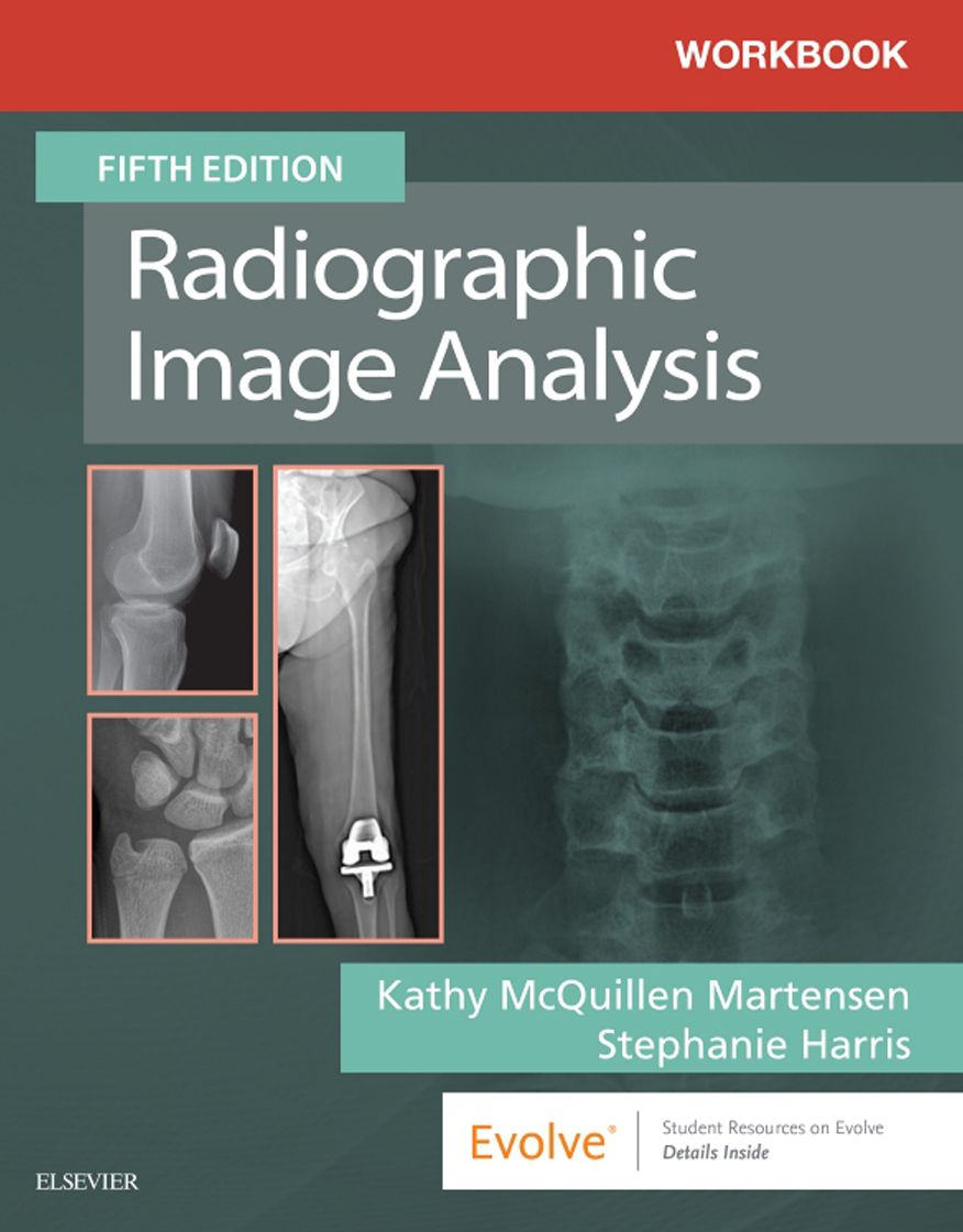 Workbook for Radiographic Image Analysis E-Book: Workbook for Radiographic Image Analysis E-Book