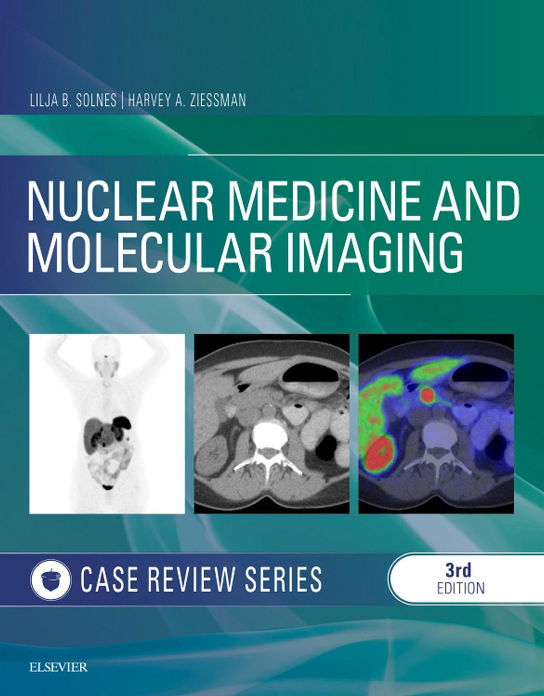Nuclear Medicine and Molecular Imaging: Case Review Series E-Book: Nuclear Medicine and Molecular Imaging: Case Review Series E-Book