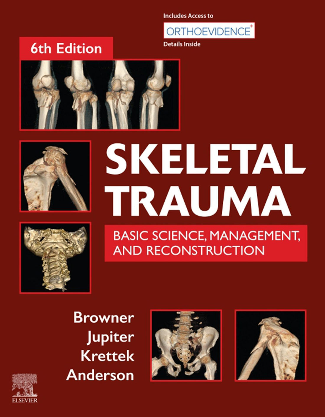 Skeletal Trauma E-Book: Basic Science, Management, and Reconstruction. 2 Vol Set
