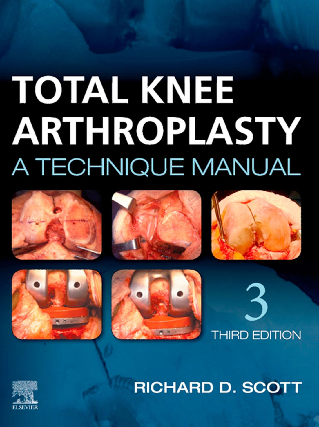 Total Knee Arthroplasty E-Book: A Technique Manual