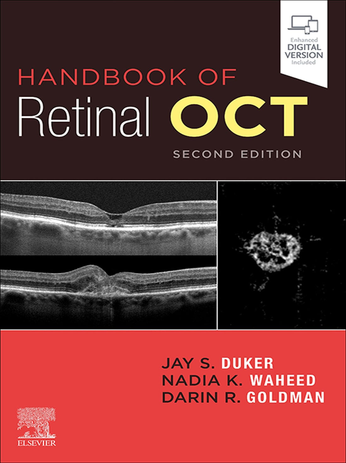 Handbook of Retinal OCT: Optical Coherence Tomography E-Book