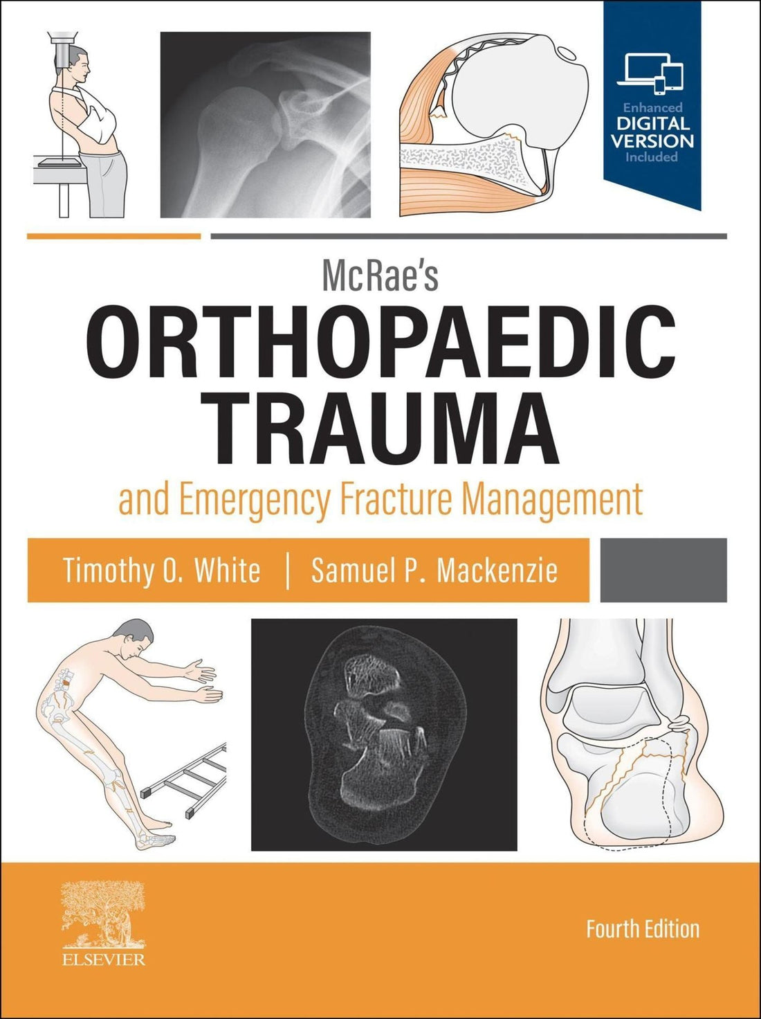 McRae's Orthopaedic Trauma and Emergency Fracture Management E-Book: McRae's Orthopaedic Trauma and Emergency Fracture Management E-Book