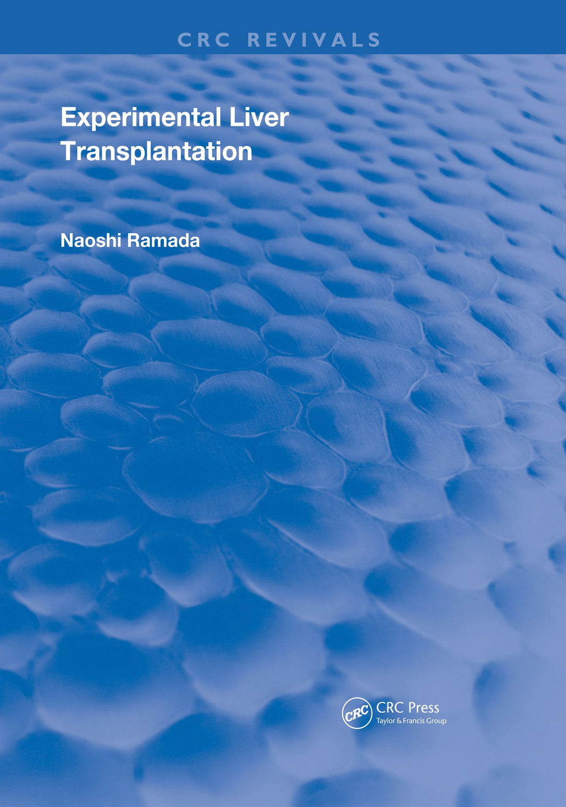 Experimental Liver Transplantation