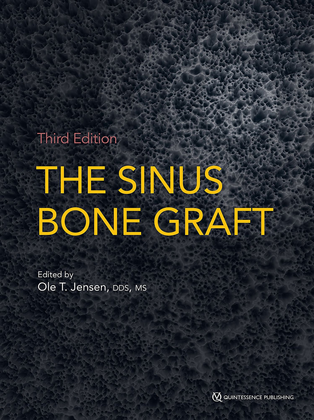 The Sinus Bone Graft: Third Edition