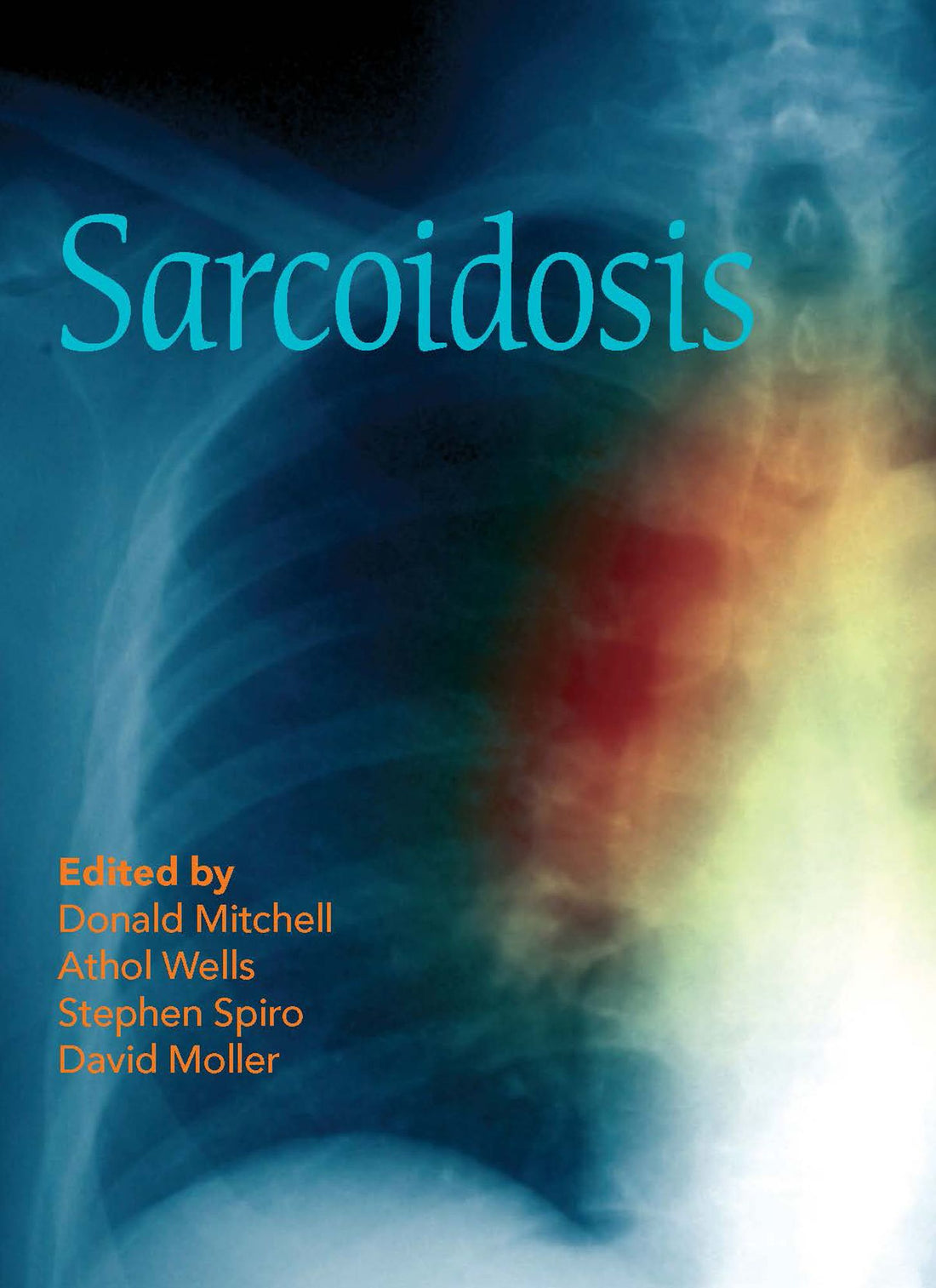 Sarcoidosis