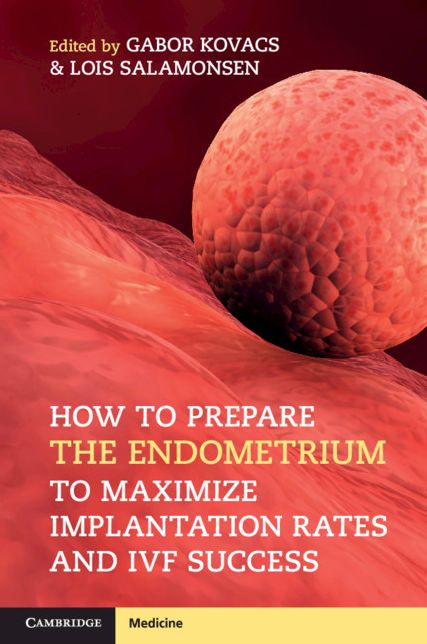 How to Prepare the Endometrium to Maximize Implantation Rates and IVF Success