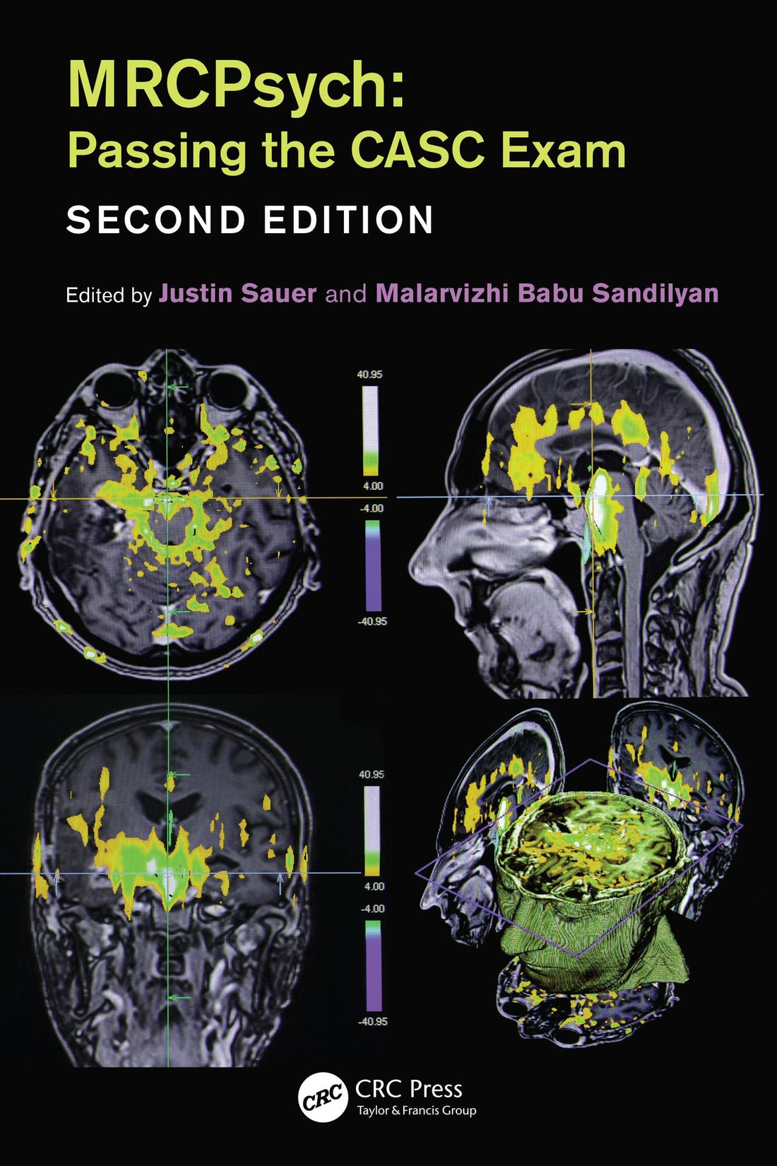 MRCPsych: Passing the CASC Exam, Second Edition