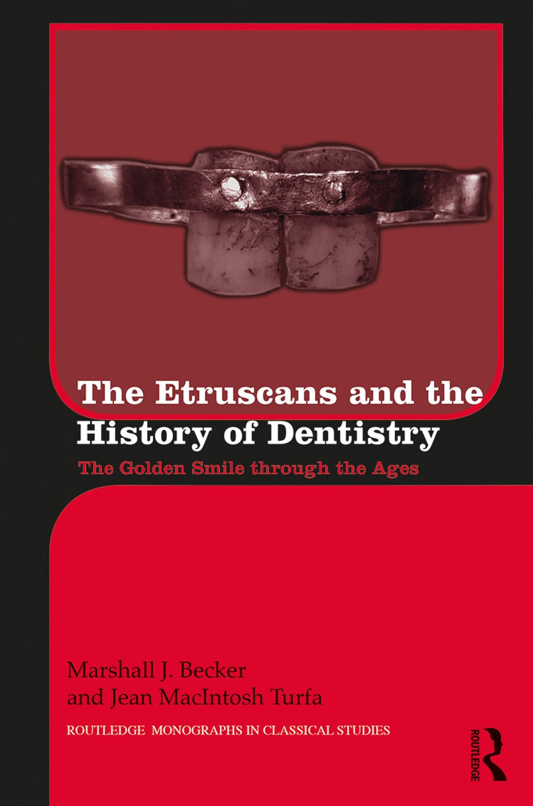 The Etruscans and the History of Dentistry: The Golden Smile through the Ages