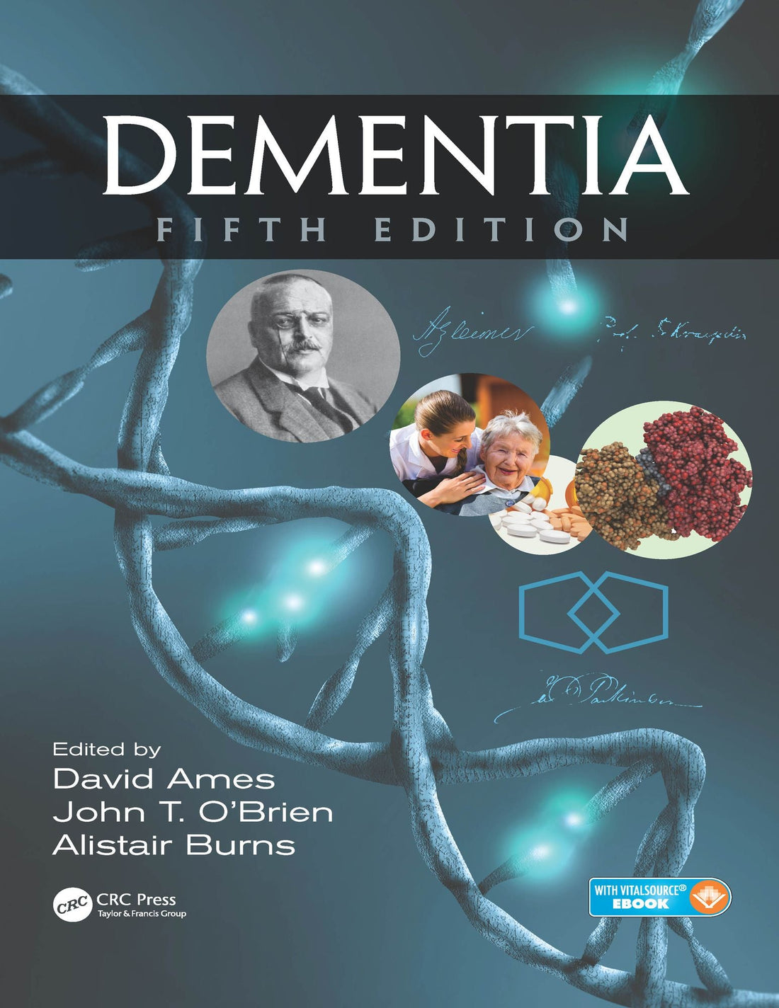 Dementia