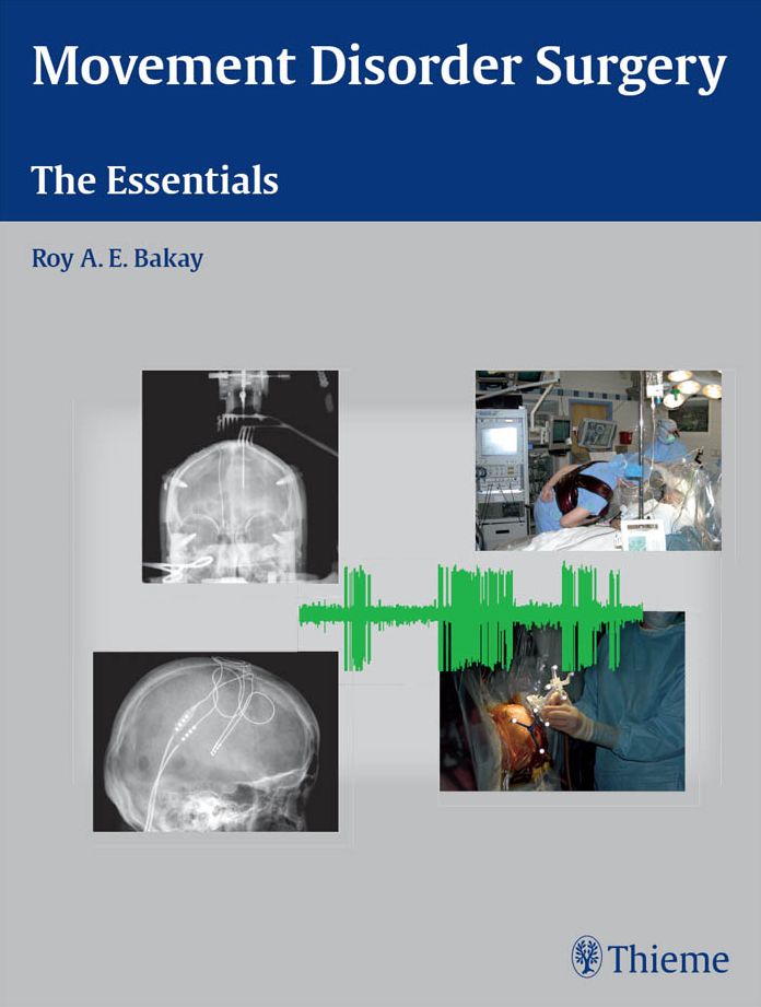 Movement Disorder Surgery: The Essentials