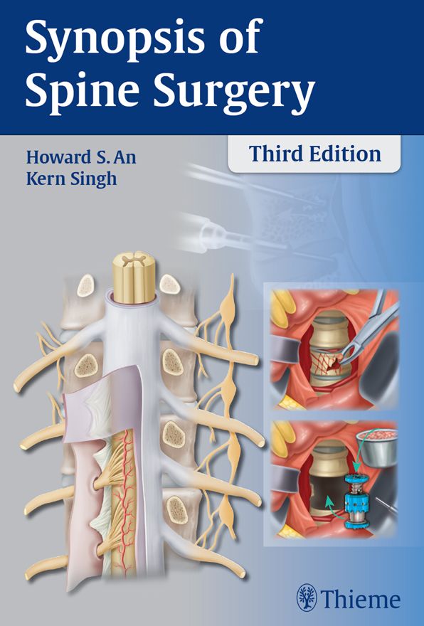 Synopsis of Spine Surgery