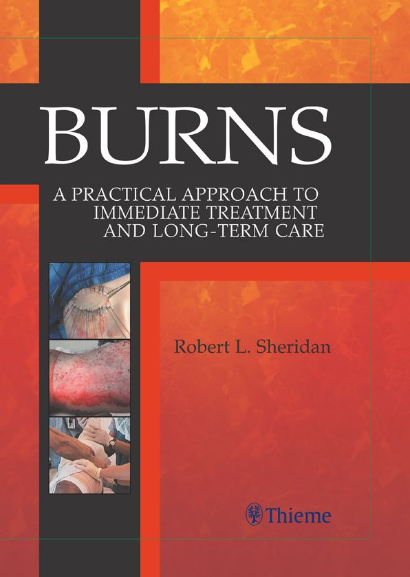 Burns: A Practical Approach to Immediate Treatment and Long-Term Care