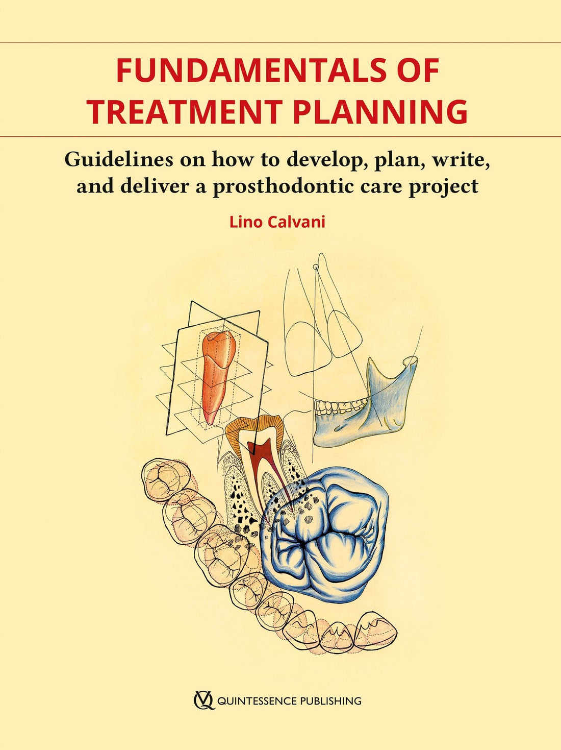 Fundamentals of Treatment Planning: Guidelines on How to Develop, Plan, Write, and Deliver a Prosthodontic Care Project