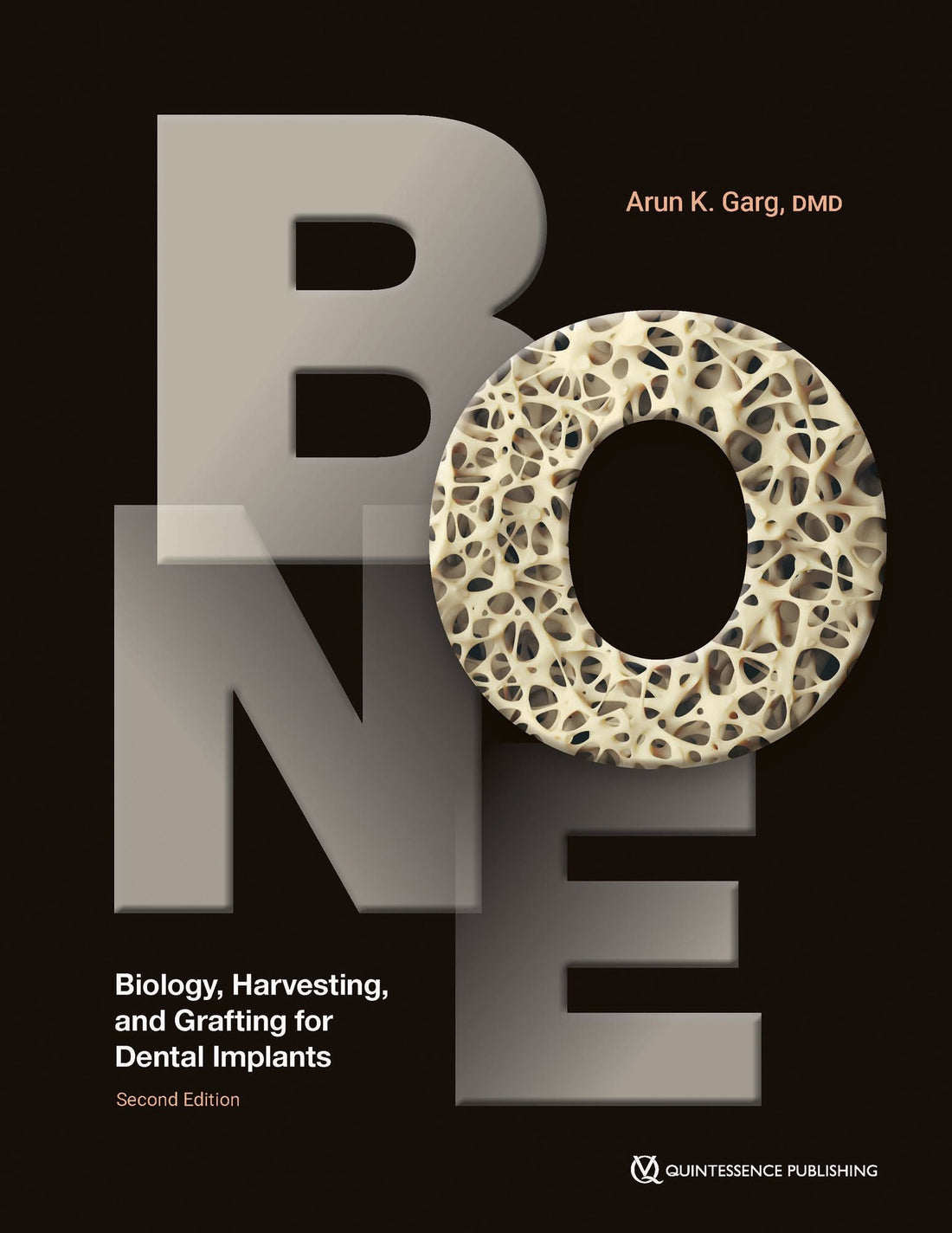 Bone: Biology, Harvesting, and Grafting for Dental Implants, 2nd Edition