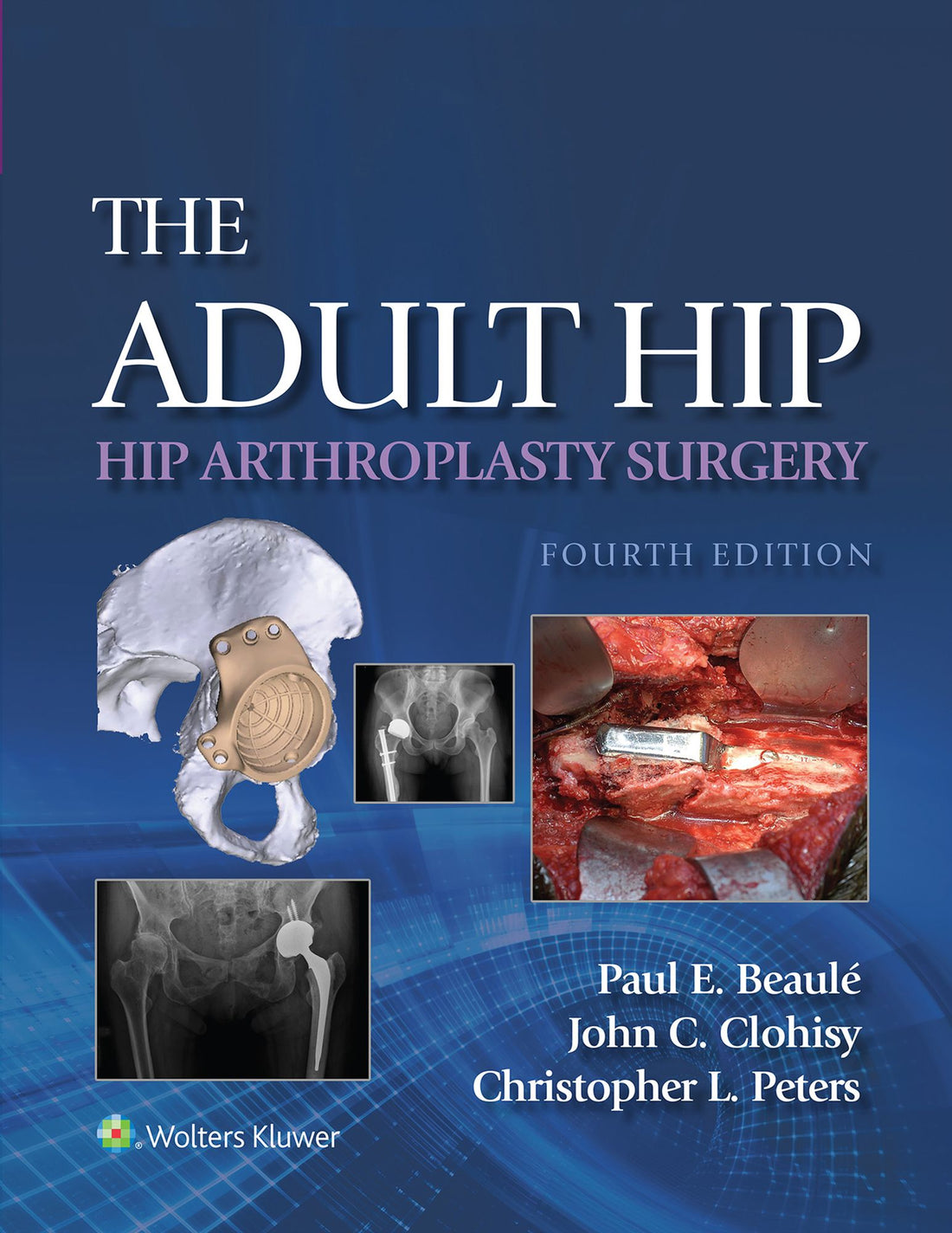 The Adult Hip: Hip Arthroplasty Surgery: book without Multimedia